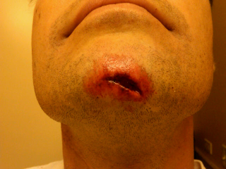 Illustration for article titled Blood Writes: When Playing Street Football, Watch Out For Windows